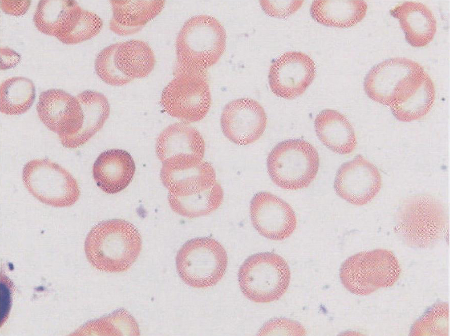 小红细胞